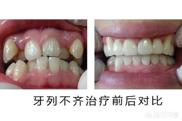 丽江最新24小时牙医在线咨询方法分析(最方便真实的丽江有没有24小时牙医方法)