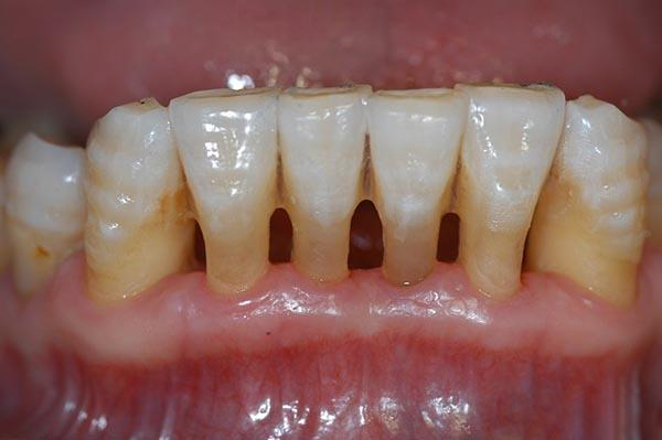 丽江最新24小时牙医在线咨询方法分析(最方便真实的丽江有没有24小时牙医方法)